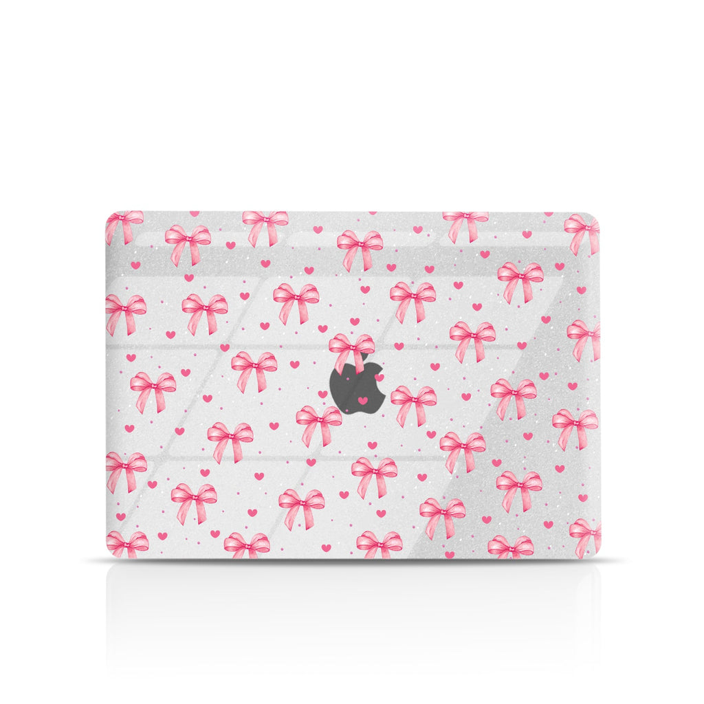 Bow Crush MacBook Case